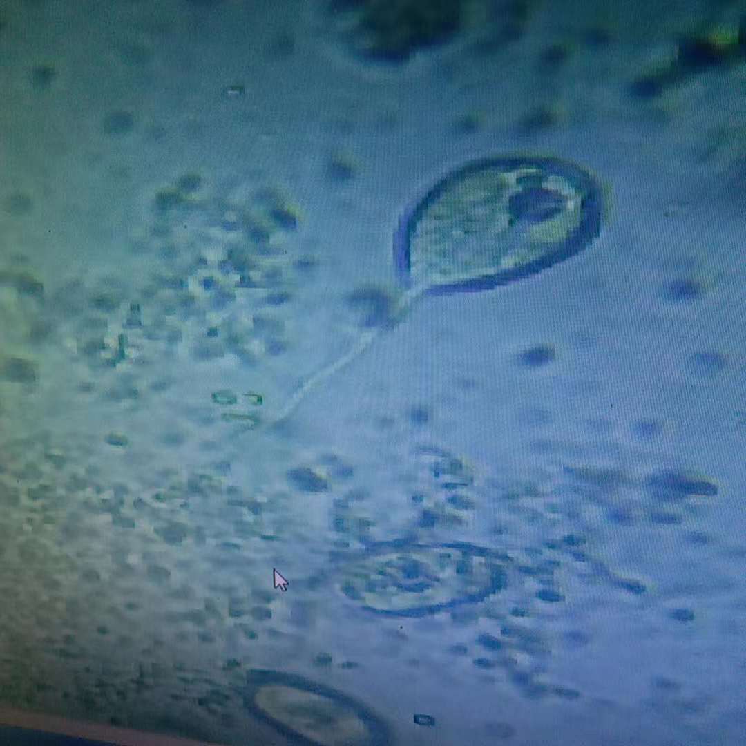 2000倍下的盤錦河蟹