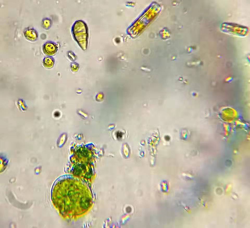 600倍顯微鏡下的水環(huán)境-多種綠藻和硅藻